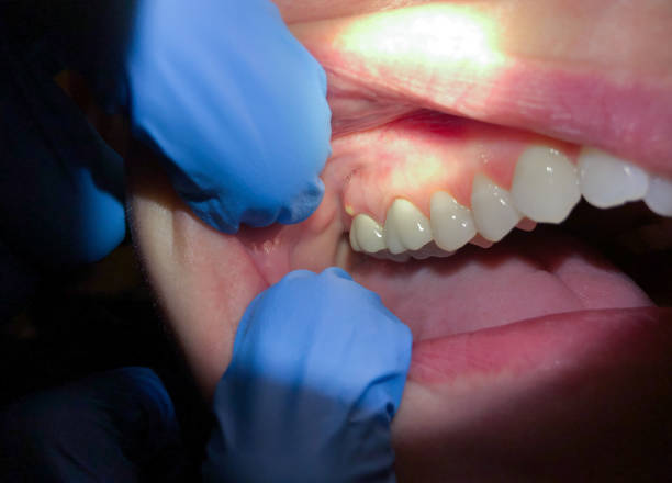 Best Emergency Dentist for Knocked-Out Tooth in Ringwood, NJ